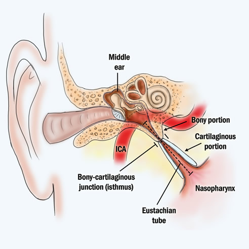 middle-ear Eustachian Tube Balloon Dilation System Glendale & Burbank, CA - (SCENTAA)