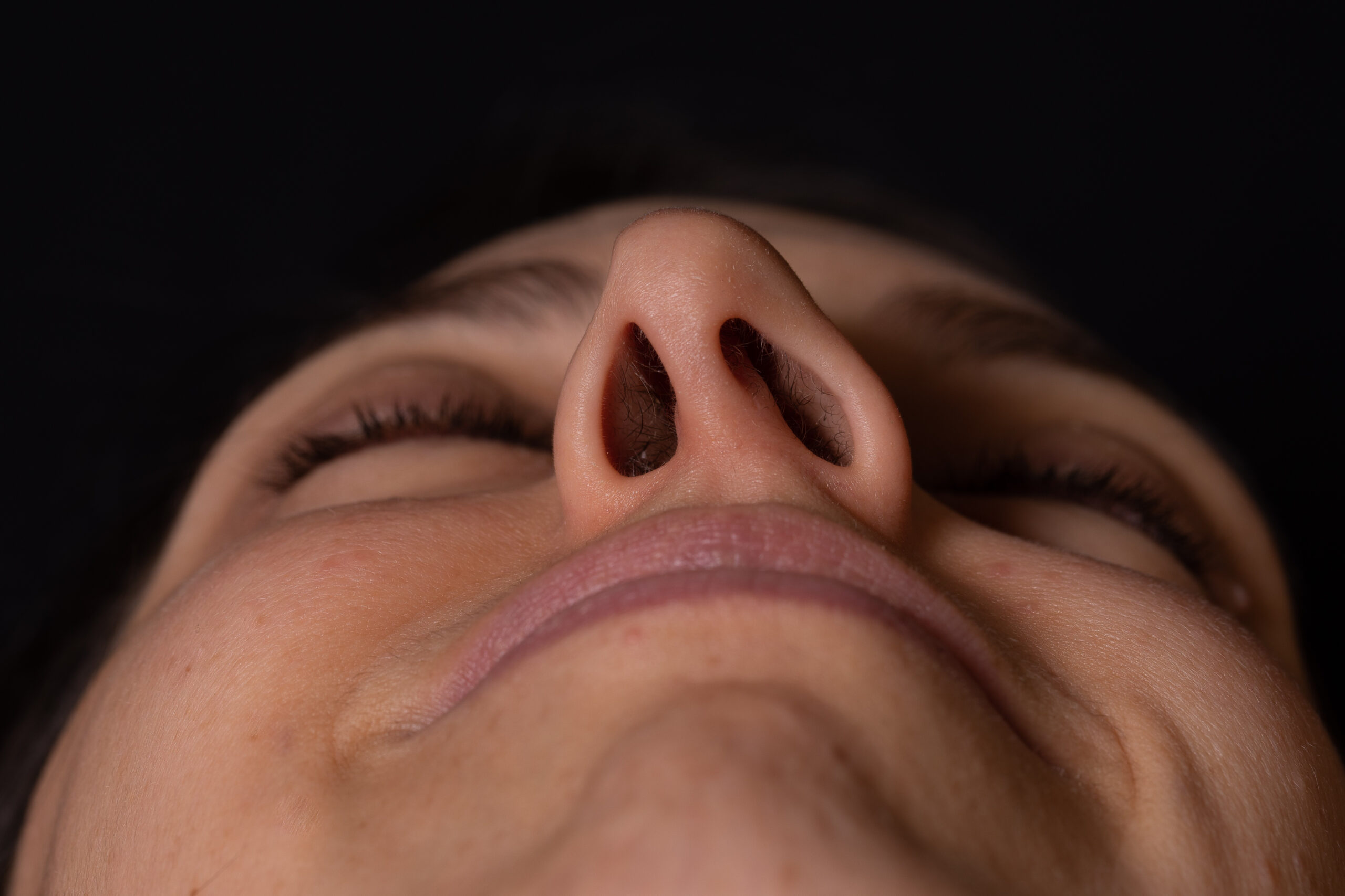 Detail,Of,Woman,Face,Seen,In,Perspective,,Showing,Deviated,Nasal