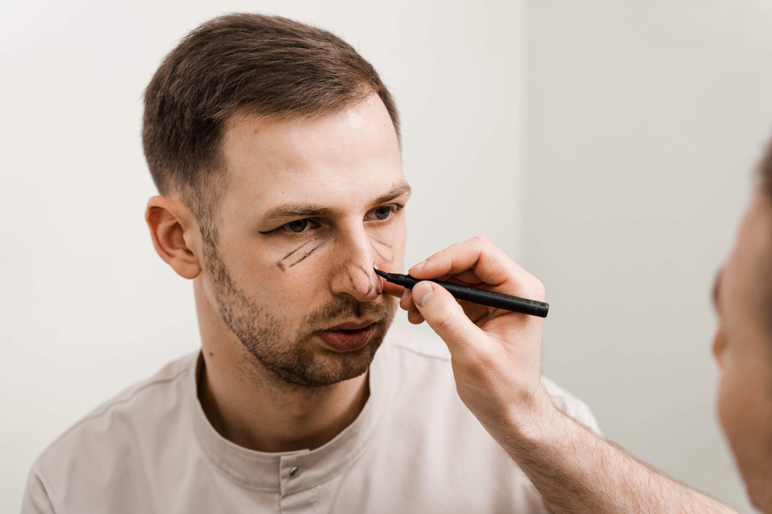 Male,Rhinoplasty,Markup,Close-up.,Blepharoplasty,With,Hernia,Removal,Marking,On